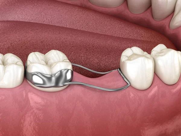 Unlock Confidence Through Expert Cosmetic Dental Care